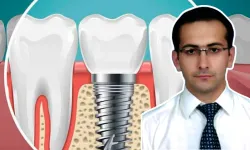 Uşak Diş Hekimliği Fakültesi’nde İmplant Çakma Rekoru!