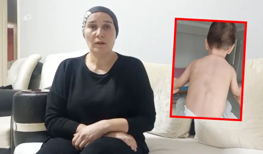 Otizmli Çocuğun Annesinden İsyan; "Adalet İstiyoruz"