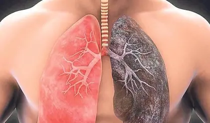 Akciğerler, vücudumuzun en önemli organlarından biridir. Soluduğumuz havayı kanımıza taşıyan akciğerler, aynı zamanda zararlı maddelerden de arınmamızı sağlar. 